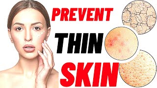 How to prevent and treat thinning skin 18 tips [upl. by Luhe342]