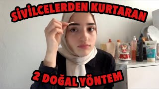 SİVİLCELERDEN 1 GECEDE KURTARAN 2 DOĞAL ÇÖZÜM EVDE [upl. by Knarf544]