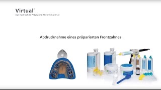 Virtual  Abformung eines präparierten Frontzahnes [upl. by Patrizia354]