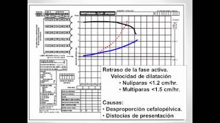 Como elaboramos el partograma [upl. by Gaut555]