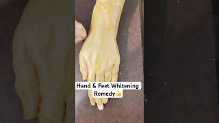 Hand amp Feet Whitening Remedy handfeetwhitening menicure pedicure shortsvideo viralshorts short [upl. by Natek]