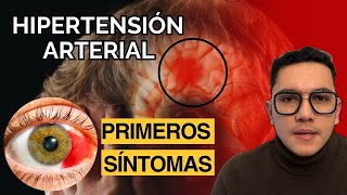 Primeros síntomas de hipertensión arterial  Dr William Guerrero [upl. by Ferretti830]