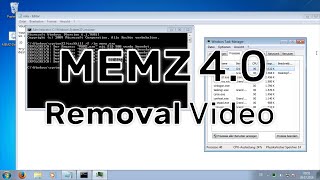 MEMZ 40  Removal Video [upl. by Zacharia]