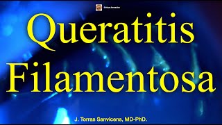 Queratitis Filamentosa Síndrome de Ojo Seco [upl. by Rosio]