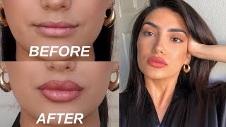 HOW TO FAKE BIG LIPS IN 3 EASY STEPS OMG [upl. by Schober747]