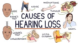 Understanding the Causes of Hearing Loss [upl. by Anum]