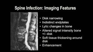 Understanding Basic MRI of the Spine [upl. by Schramke]