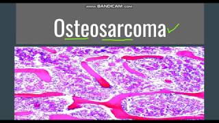 Osteosarcoma GeneralMorphology SubtypesClinical features [upl. by Hare341]