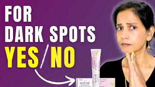 Is Kozicare Skin Whitening Cream REALLY Worth the Hype [upl. by Samul901]