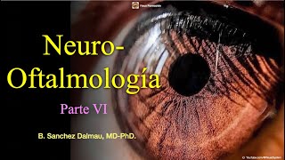 Neuroftalmología Parte VI [upl. by Terrene]