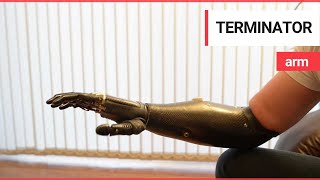 Terminator arm is worlds most advanced prosthetic limb  SWNS TV [upl. by Imtiaz]