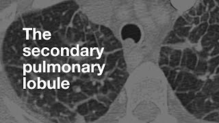 The Secondary Pulmonary Lobule [upl. by Verner]