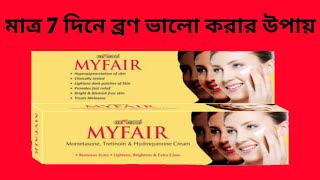 My Fair Cream মাত্র 7 দিনে ব্রনো ভালো করার উপায় Myfair Cream Bangla Review [upl. by Naellij889]