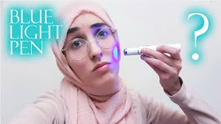 BLUE LIGHT PEN ACNE REVIEWS Blue Light Pen Does It Work Blue Light Pen Instructions [upl. by Ttoille]