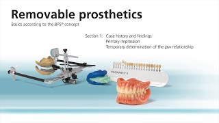 Removable prosthetics workflow 17 – First clinical appointment [upl. by Oahc]