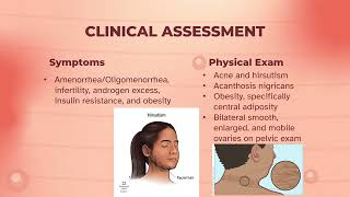 Polycystic Ovary Syndrome PCOS [upl. by Zara585]