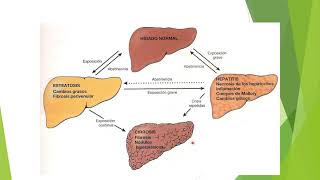 Hepatopatía alcohólica [upl. by Hairas]