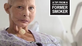 CDC Tips From Former Smokers  Becky H Not What I Pictured [upl. by Jaymie933]