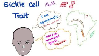 Sickle Cell Trait [upl. by Falo]