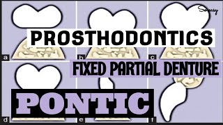 PONTIC II COMPONENT OF FIXED PARTIAL DENTURE II PROSTHODONTICS [upl. by Bobker494]