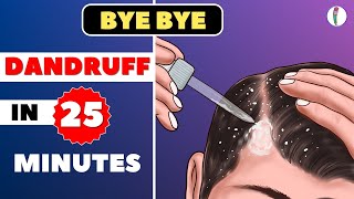 🔥1 Dandruff Treatment at Home  How to get rid of Dandruff  Dandruff Removal  Itchy scalp [upl. by Gonroff789]