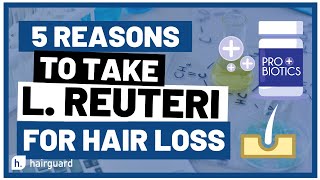 Top 5 Reasons To Take L REUTERI for HAIR LOSS [upl. by Maurreen]