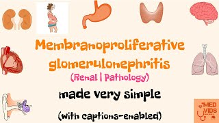 Detailed Pathogenesis of Glomerular Injury Glomerulopathy Glomerulonephritis [upl. by Newlin366]