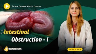 Understanding Ileus Paralytic Ileus [upl. by Theurer]