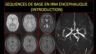 Séquences de base en IRM encéphalique Introduction [upl. by Dustin557]