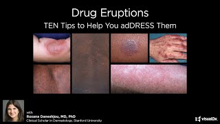 Drug Eruptions TEN tips to help you adDRESS them [upl. by Knarf]