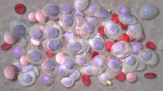 Multiple myeloma treatment at Mayo Clinic [upl. by Nayt361]