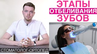 Как проходит отбеливание зубов  этапы процедуры отбеливания Домашнее отбеливание зубов [upl. by Ker]