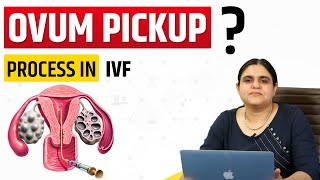 Egg Retrieval Process in Ivf Ovum Pickup in Ivf Egg Pick Up Egg Pickup in Ivf [upl. by Crin641]