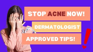 Acne The Real Causes amp Best Treatments You Need to Know [upl. by Adelaida]