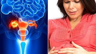 How to treat Amenorrhoea Naturally with Home Remedies [upl. by Yerak]