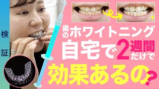 【歯科】セルフホワイトニングはどのくらい続けたら白くなる？ホームホワイトニング効果＊検証＊ [upl. by Anirtruc207]