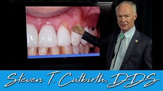 Abfraction on Tooth Colored Restorations  Dental Minute with Steven T Cutbirth DDS [upl. by Albertina933]