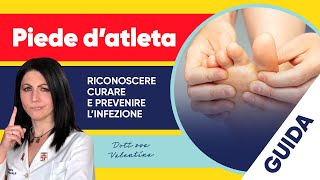 Piede d’atleta come riconoscere curare e prevenire l’infezione [upl. by Kale291]