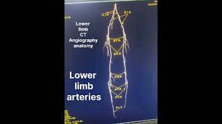 Lower limb arteries lower limb ct angiography anatomy [upl. by Burtis]