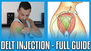 How To Do A Deltoid Injection  Full GuideDemo [upl. by Nelehyram796]