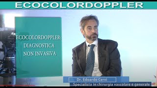 ECOCOLORDOPPLER lesame che scova linsufficienza venosa di arterie vene e capillari [upl. by Asilenna782]