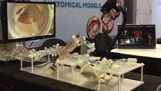 Enhanced Transseptal Mitral Model [upl. by Carlstrom]