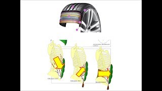 anatomie de la paroi abdominale [upl. by Newra60]