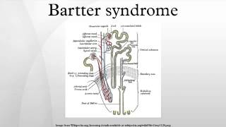 Bartter syndrome [upl. by Akayas]