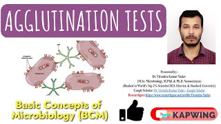 Agglutination tests I Immunology I Hemagglutination tests I Hemagglutination Inhibition tests I [upl. by Stanhope]