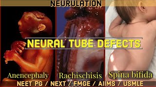 Neurulation amp Neural Tube Defects  Anencephaly vs Spina Bifida vs Rachischisis NEET PGNEXTAIIMS [upl. by Sherlock]