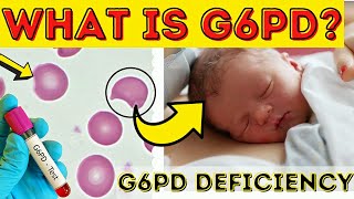 Uncovering the Mystery of G6PD Deficiency [upl. by Ilahtan546]