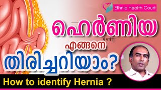 How to identify Herniaനിങ്ങൾക്ക് ഹെർണിയ ഉണ്ടോ എങ്ങനെ തിരിച്ചറിയാൻ സാധിക്കും Ethnic Health Court [upl. by Eiznek]