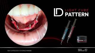 Ferulización de copings de impresión con ID Light Cure Pattern Gel Implant [upl. by Marasco]