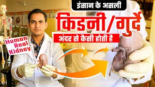 HUMAN REAL KIDNEY amp KIDNEY STONES  किडनीगुर्दे अंदर से कैसी होती है और इसमें पथरी कहाँ बनती है [upl. by Chelsae]